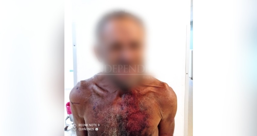 Lo discriminaron por su aspecto y protestó lesionándose con la punta de un vidrio