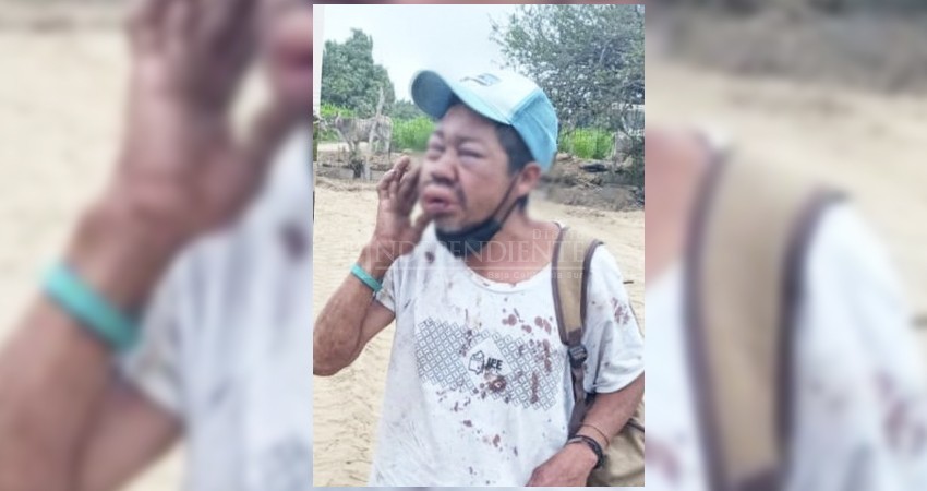 Extraños atacan a indigente y lo mandan al hospital
