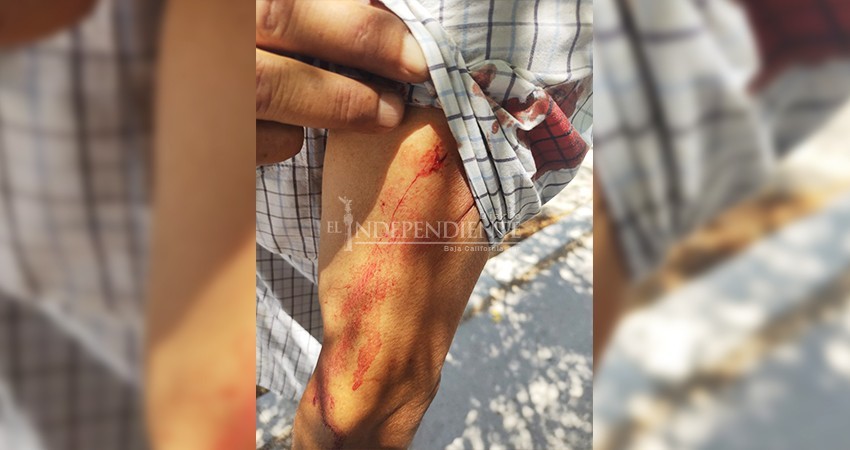 Mujer atacó a su pareja con un vidrio