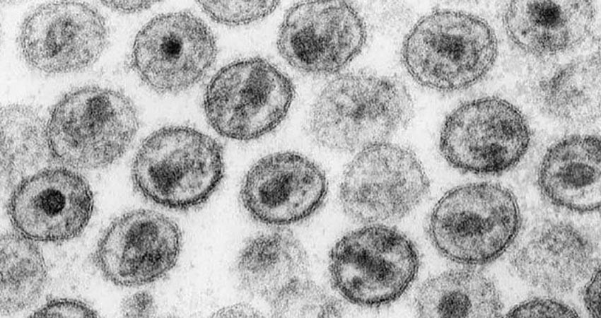 Identifican nueva variante del VIH altamente contagiosa