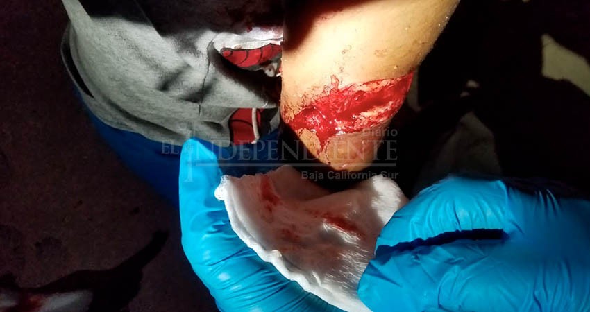 Detienen a un perro y su dueño tras  ataque del canino a un infante