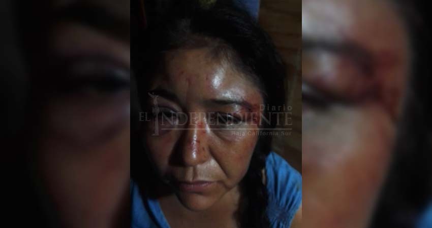 Busca justicia mujer agredida por custodio del Cereso de Santa Rosalía
