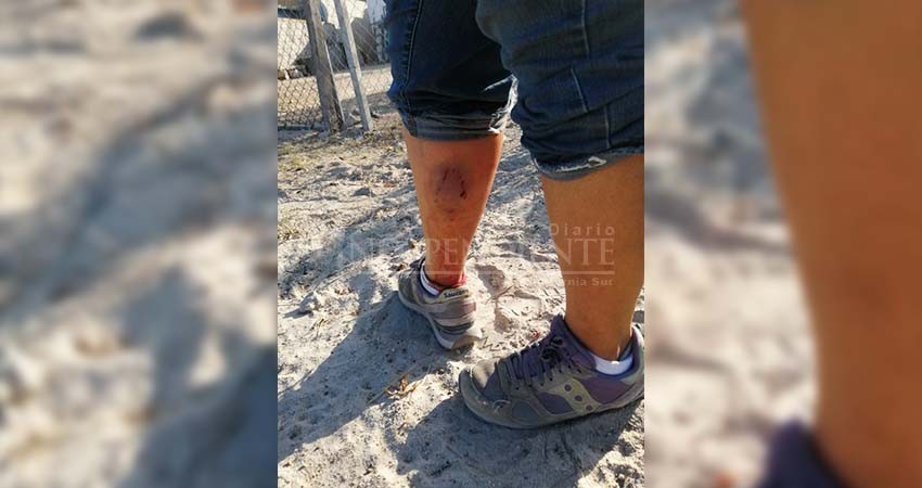 Mujer es atacada por perro en la Márquez de León