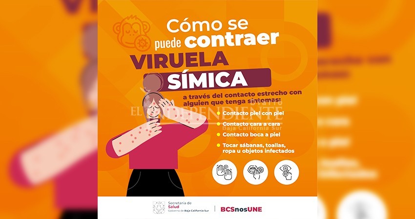 Importante seguir medidas para la prevención de la viruela símica