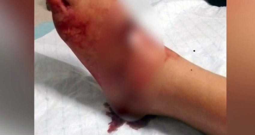 Elemento de Guardia Nacional en Loreto se disparó en el pie