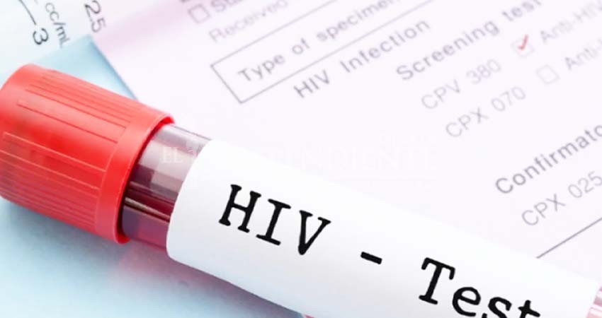 Baja California Sur, con el menor índice de casos de VIH