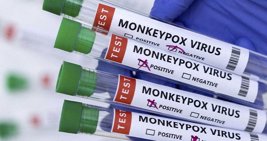 Identifican una nueva forma severa de la viruela del mono con alta mortalidad