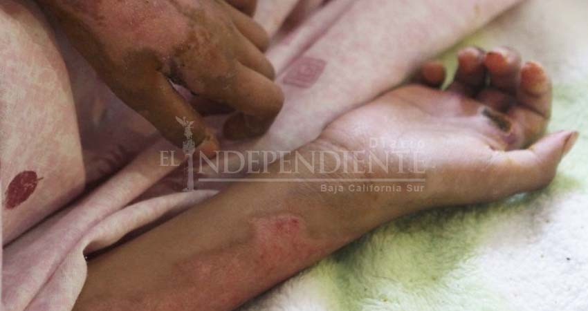 En lo que va del año, cuatro menores han sufrido quemaduras: Bomberos