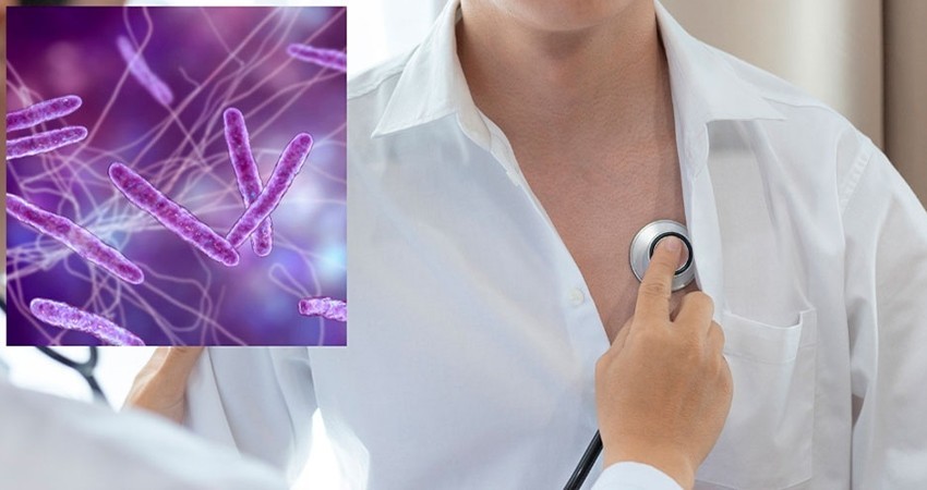 Tuberculosis en México: Suman 4 mil 113 casos en lo que va del año