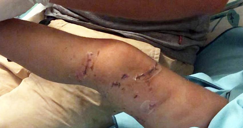 Presentan iniciativa “Ley Santos” para sancionar ataques de animales por omisión de dueños