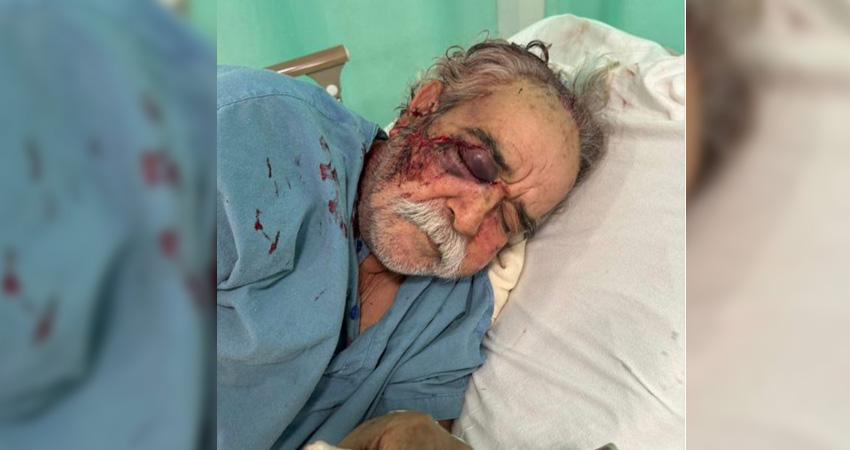 Inician investigación por “golpiza” a un adulto mayor en La Paz