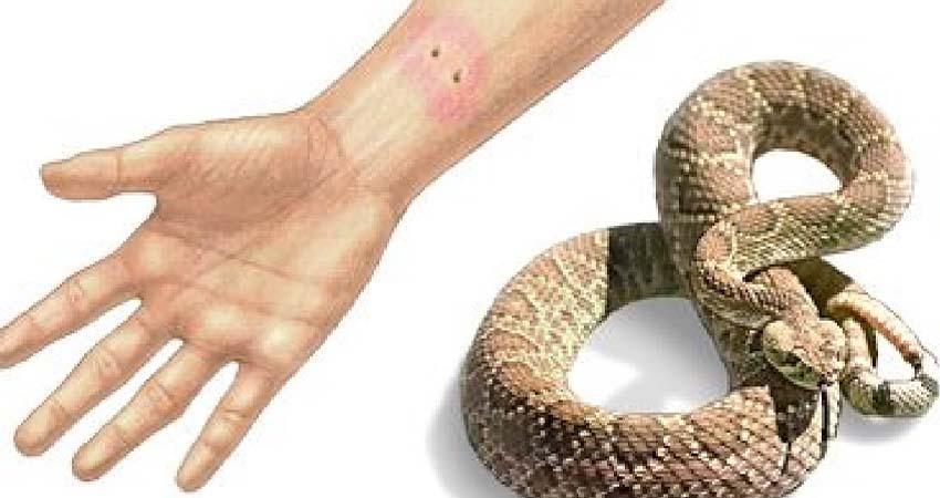 SSA: Hospitales IMSS Bienestar en BCS cuenta con antídotos por picaduras y mordeduras