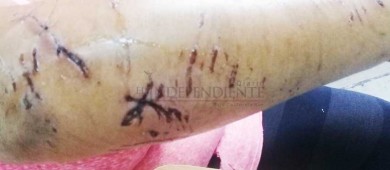 Casi matan a una señora unos Pitbulls en Cd Constitución