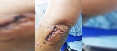 Casi matan a una señora unos Pitbulls en Cd Constitución