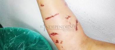 Casi matan a una señora unos Pitbulls en Cd Constitución