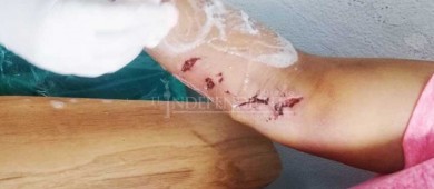 Casi matan a una señora unos Pitbulls en Cd Constitución