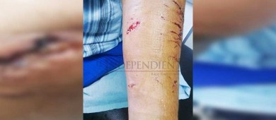 Casi matan a una señora unos Pitbulls en Cd Constitución