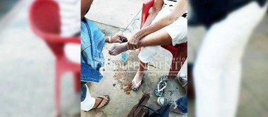 Una constante, lesiones en turistas que caminan por el centro de CSL