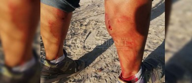 Mujer es atacada por perro en la Márquez de León