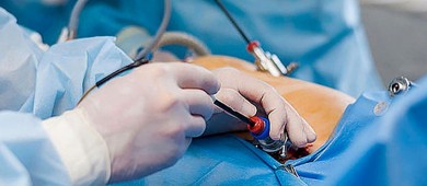 Adquisición de anestésicos son responsabilidad del hospital, no de médicos: Cofepris