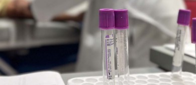 Ácido úrico elevado pone en riesgo la salud: IMSS Baja California Sur