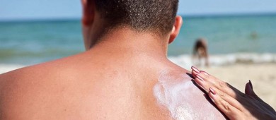 Ciudadanos no deben exponerse demasiado al sol para evitar quemaduras solares: IMSS