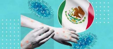 Viruela del mono: Estos estados han reportado casos en México
