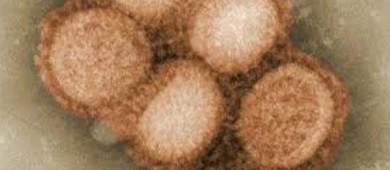 Muere mexicano no vacunado por el actual brote de sarampión