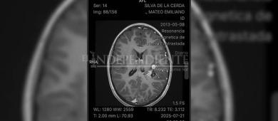 Organizan colecta de recursos para un menor en San José del Cabo, requiere de cirugía cerebral