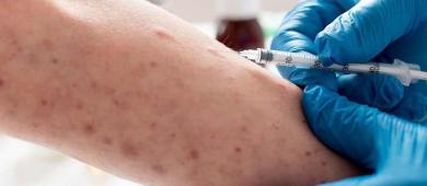 Alertan que México podría perder su certificación de eliminación del sarampión