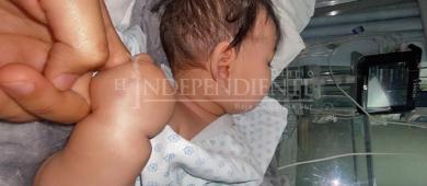 Tiene 2 años y pelea contra una enfermedad que afecta a 10 niños en el mundo